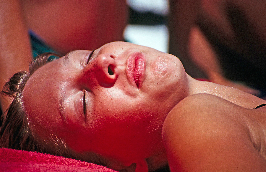 Rostro de mujer tumbada con los ojos cerrados tomando el sol, piel enrojecida por el calor