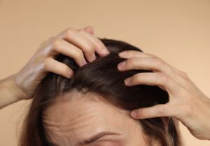 Mujer examinando su cuero cabelludo preocupada por la caída del cabello